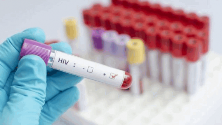 วัคซีน HIV มีแววพัฒนาสำเร็จหลังทดสอบในมนุษย์แล้วผลลัพธ์ค่อนข้างดี
